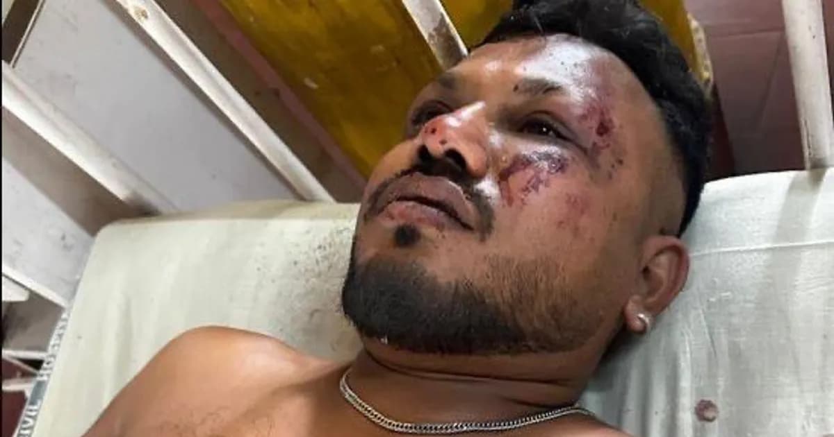 Homem que sobreviveu a queda de avião com mais de 200 passageiros na Índia recebe assistência médica