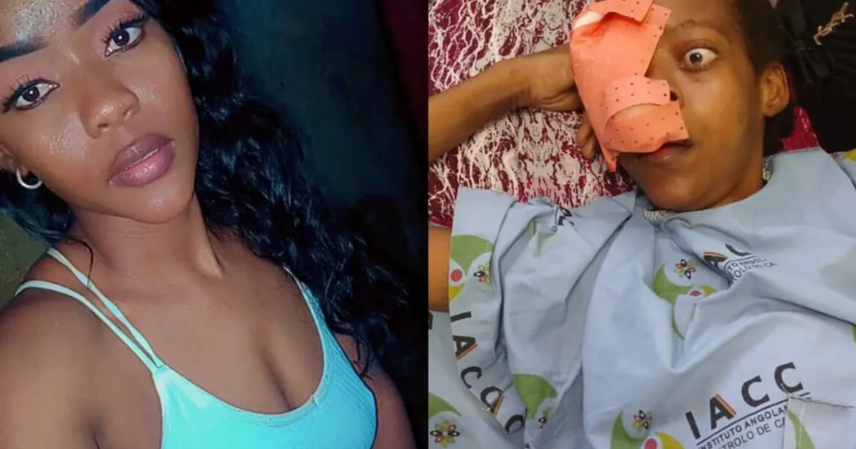 Jovem com tumor maligno agressivo nas narinas clama por ajuda médica